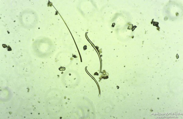 Oligochaeta, Borsten, mikrosk. Aufnahme, Nahrungsrest C. boltoni, ,