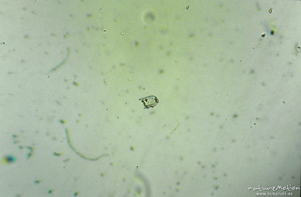Copepoda ?, Abdominal- oder Thoraxsegement, mikroskop. Aufnahme, Nahrungsrest C. boltoni, ,