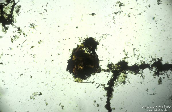 Plecoptera, Mandibel, mikroskop. Aufnahme, Nahrungsrest C. boltoni, ,