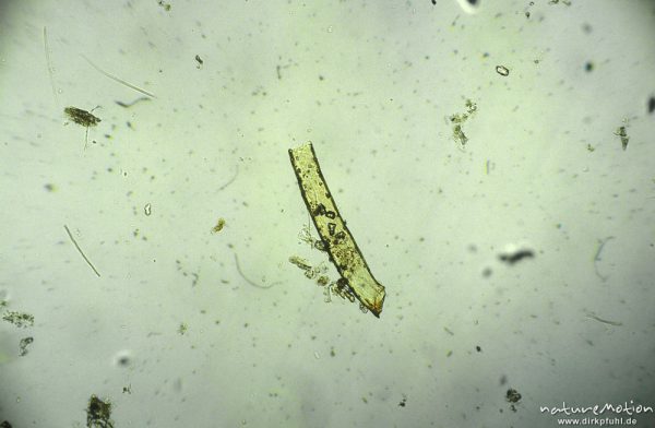 Plecoptera, Beinröhre, mikroskop. Aufnahme, Nahrungsrest C. boltoni, ,