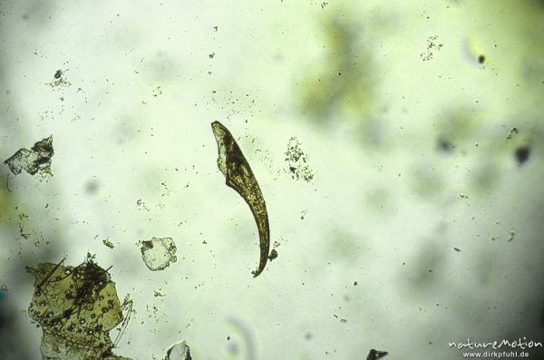 Plecoptera, Kralle, mikroskop. Aufnahme, Nahrungsrest C. boltoni, ,