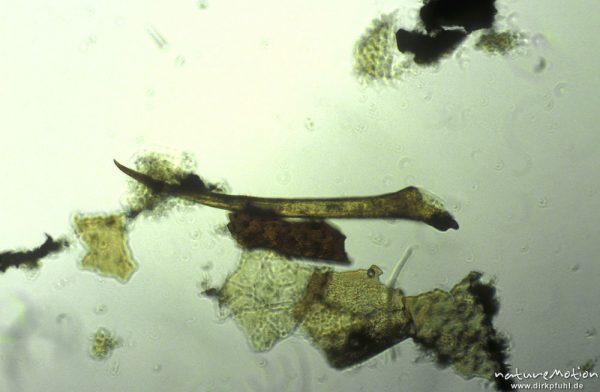 Megaloptera, Kralle, mikroskop. Aufnahme, Nahrungsrest C. boltoni, ,