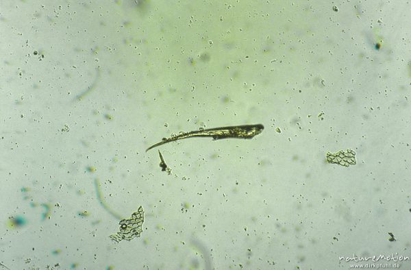 Dytiscidae, Kralle, mikroskop. Aufnahme, Nahrungsrest C. boltoni, ,