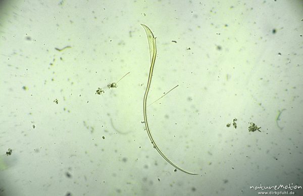 Simuliidae, Haar des Filtrierapparatses, mikroskop. Aufnahme, Nahrungsrest C. boltoni, ,