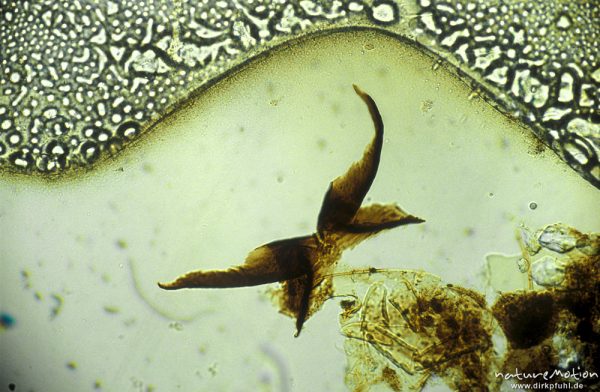 Simuliidae, Abdominalsternit, mikroskop. Aufnahme, Nahrungsrest C. boltoni, ,