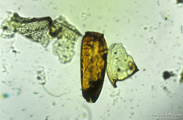 Ceratopogonidae, Kopfkapsel, mikroskop. Aufnahme, Nahrungsrest C. boltoni, ,
