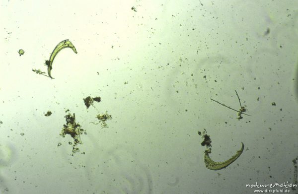 Chironomidae, Abdominalkrallen, mikroskop. Aufnahme, Nahrungsrest C. boltoni, ,
