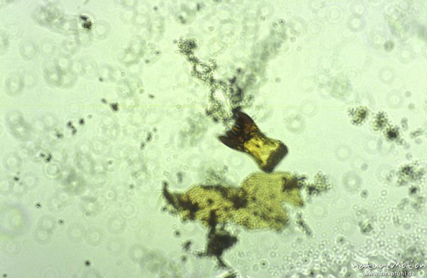 Tanipodinae, Labium, mikroskop. Aufnahme, Nahrungsrest C. boltoni, ,