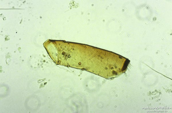 Trichoptera, Beinröhre, mikroskop. Aufnahme, Nahrungsrest C. boltoni, ,
