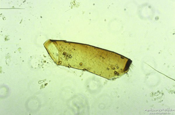 Trichoptera, Beinröhre, mikroskop. Aufnahme, Nahrungsrest C. boltoni, ,