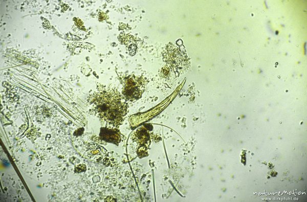 Trichoptera, Kralle, mikroskop. Aufnahme, Nahrungsrest C. boltoni, ,