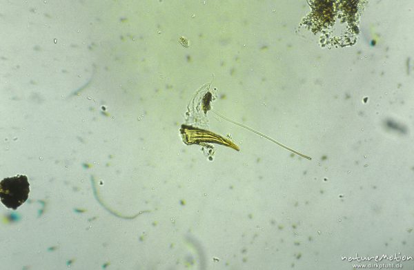 Trichoptera, Kralle mit Dorn, mikroskop. Aufnahme, Nahrungsrest C. boltoni, ,