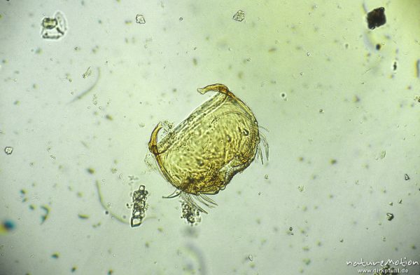 Sericostoma, Labrum, mikroskop. Aufnahme, Nahrungsrest C. boltoni, ,