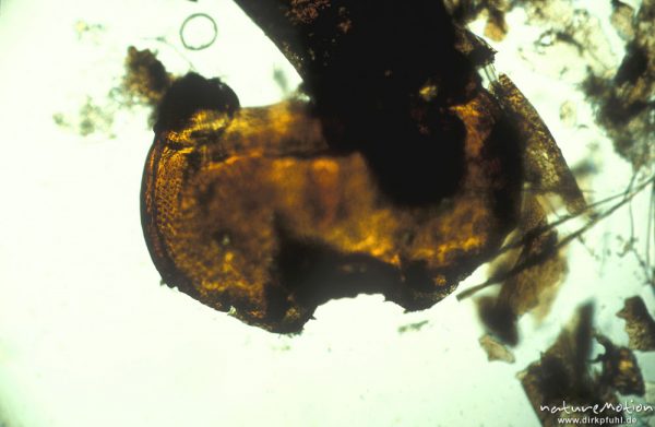 Limnephilidae, Labrum, mikroskop. Aufnahme, Nahrungsrest C. boltoni, ,