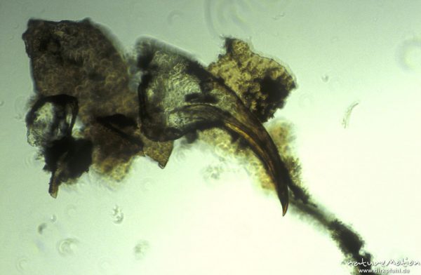 Dytiscidae, Mandibel, mikroskop. Aufnahme, Nahrungsrest C. boltoni, ,